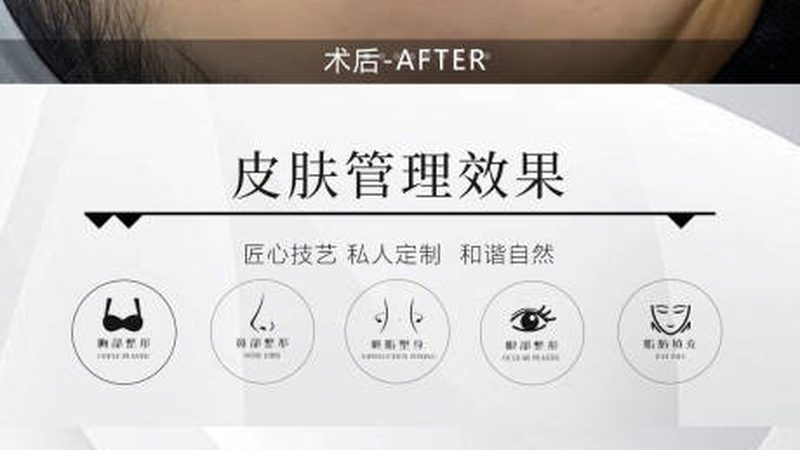 术后修复第一步，选对面膜比药膏更重要