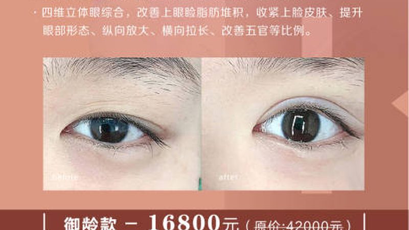 激光祛斑术后，如何正确护理肌肤？**