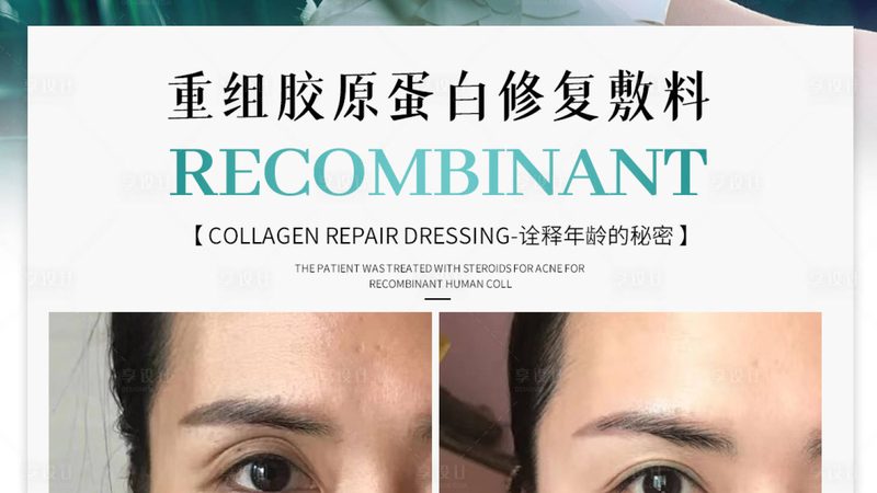 北京埋线提升术后恢复：揭秘时间与注意事项
