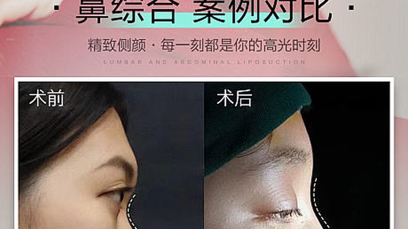 线上还是线下？揭秘医美咨询师培训的优劣势
