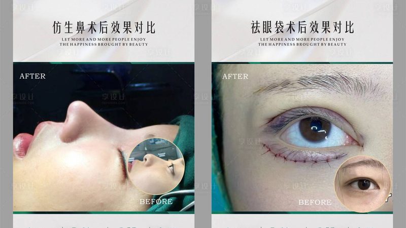 双眼皮修复，费用不只是数字游戏