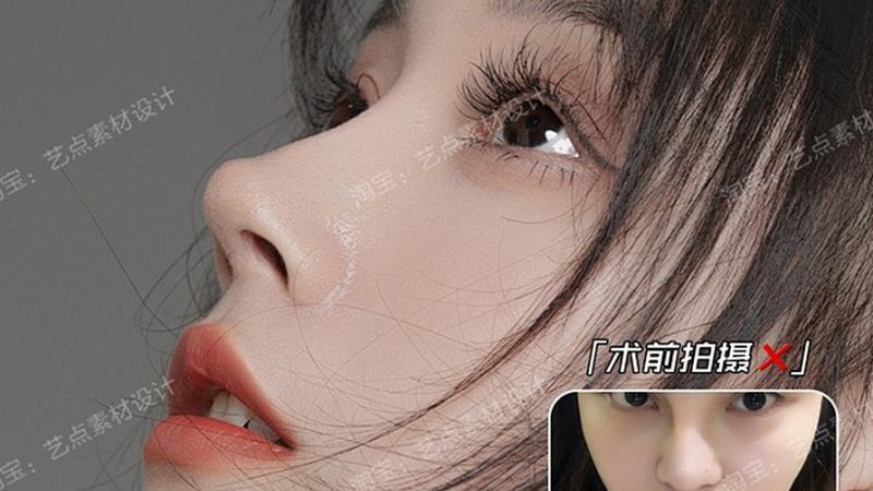 热玛吉厂家选择，避开这五个常见认知偏差