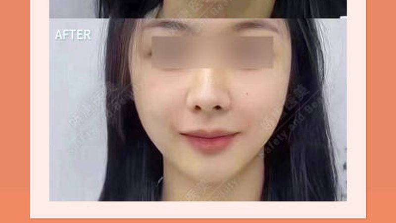 皮肤管理门店拓客管理系统