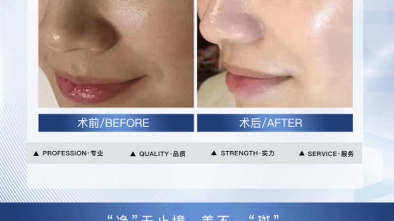 术后黄金72小时，你的护肤可能全做错了