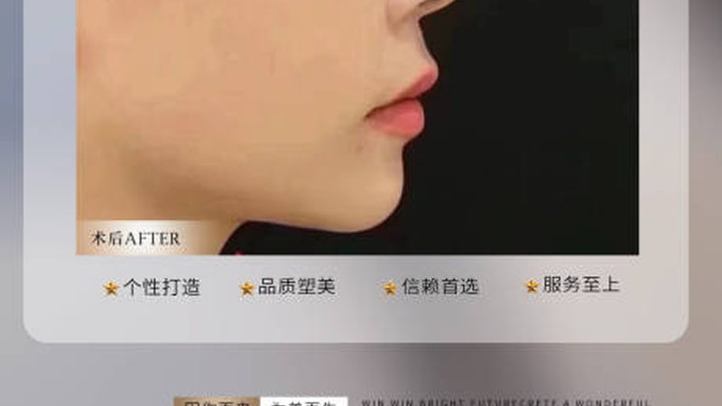 超声炮加盟合同模板：揭秘加盟流程中的关键要素