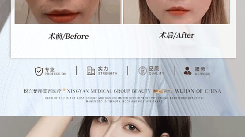 揭秘上海激光美容医院排名背后的真相