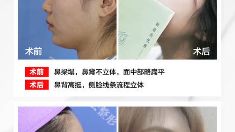 成都轻医美OEM定制：揭秘轻医美产品背后的秘密