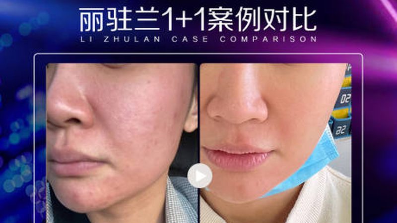 行业现状：市场细分，需求多样化