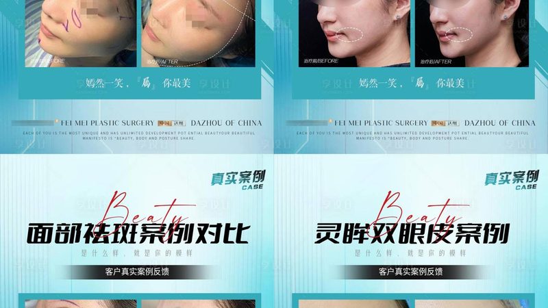 注射类医美项目，这些注意事项你了解吗？**