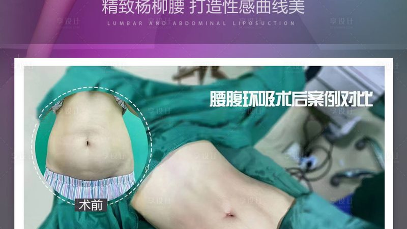 蛋白线面部提升，揭秘其神秘步骤