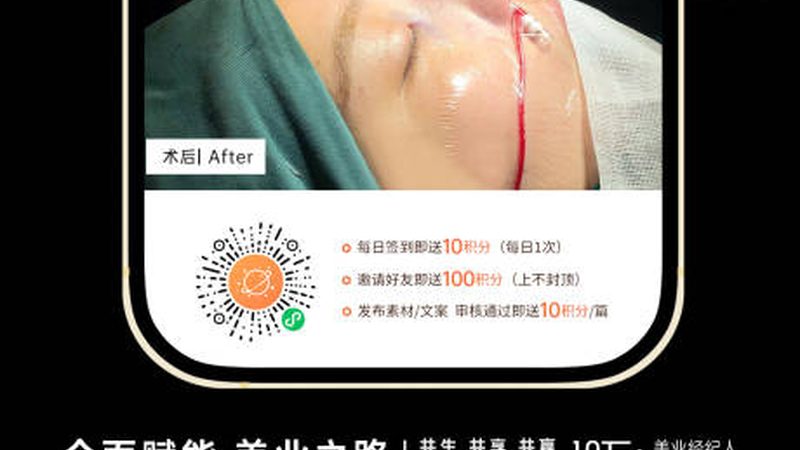 隆鼻失败修复：风险与应对之道