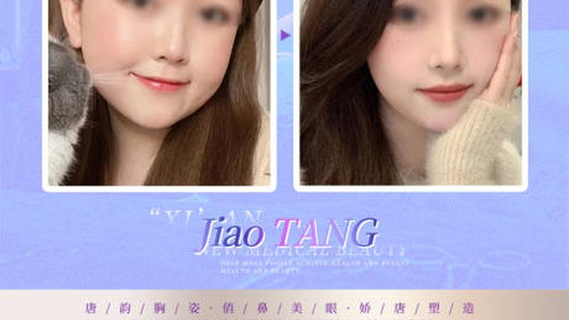 激光美容与光子嫩肤：揭秘价格背后的秘密