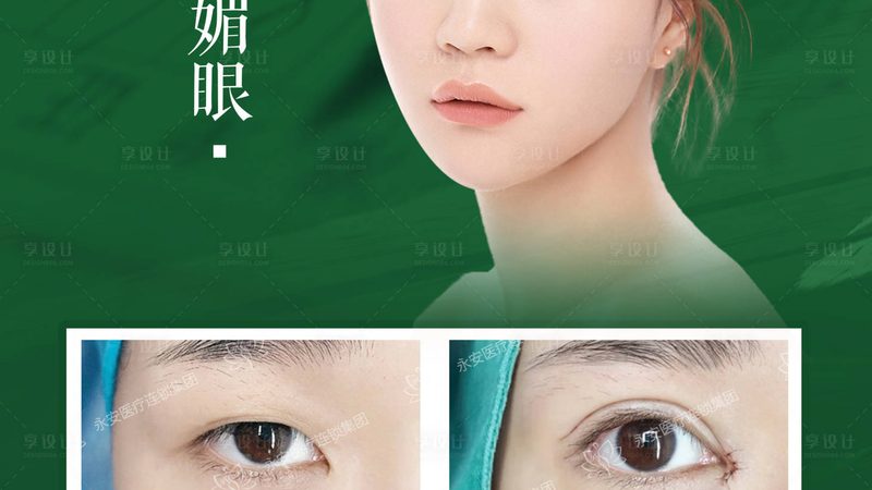 医美咨询师面试，揭秘专业之路的五大步骤