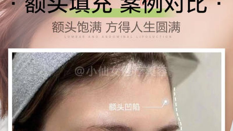 热玛吉广州价格表2025：揭秘价格背后的秘密