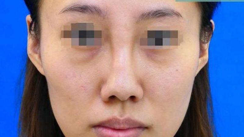 医美术前体检主要包括以下几个方面：